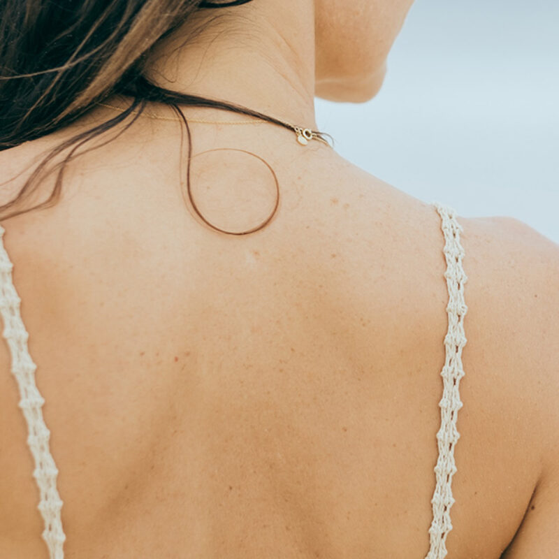 Haut am Rücken einer Patientin bei SanaSkin Zürich Hautarzt